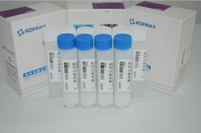 脂肪酶(LIP)測(cè)定試劑盒(酶法)_測(cè)定試劑盒銷售信息_環(huán)球醫(yī)療器械網(wǎng)